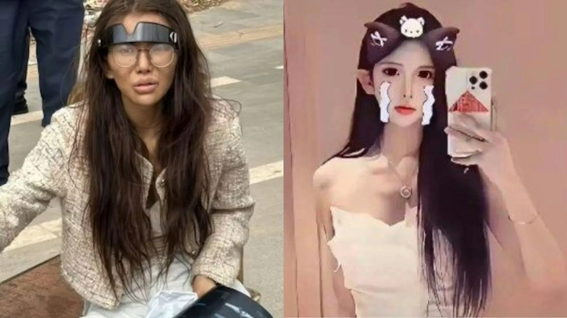 女网红断腿街头流浪 直播揭卖猪仔内幕 帐号突遭封禁