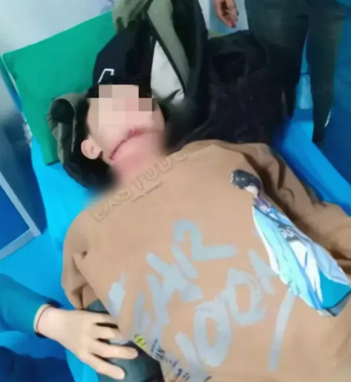 13岁男孩被老人拉绳锁喉，已赴京治疗脱离危险