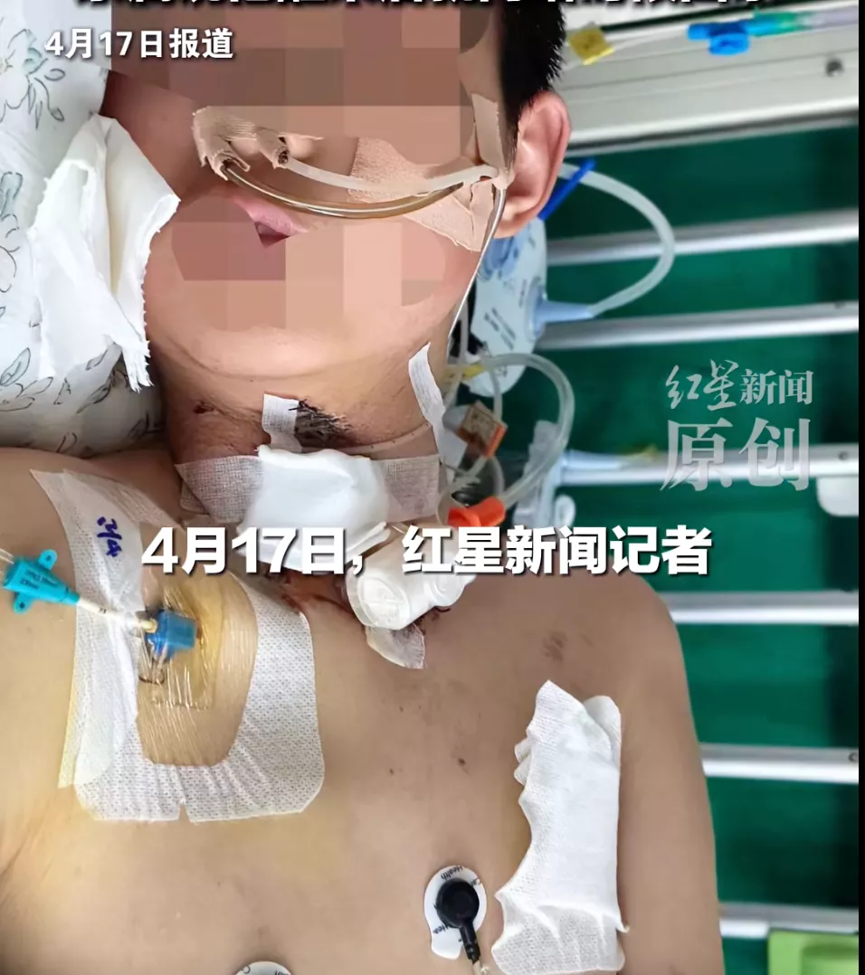 骑车遭割喉的13岁男孩已苏醒，目前无法说话