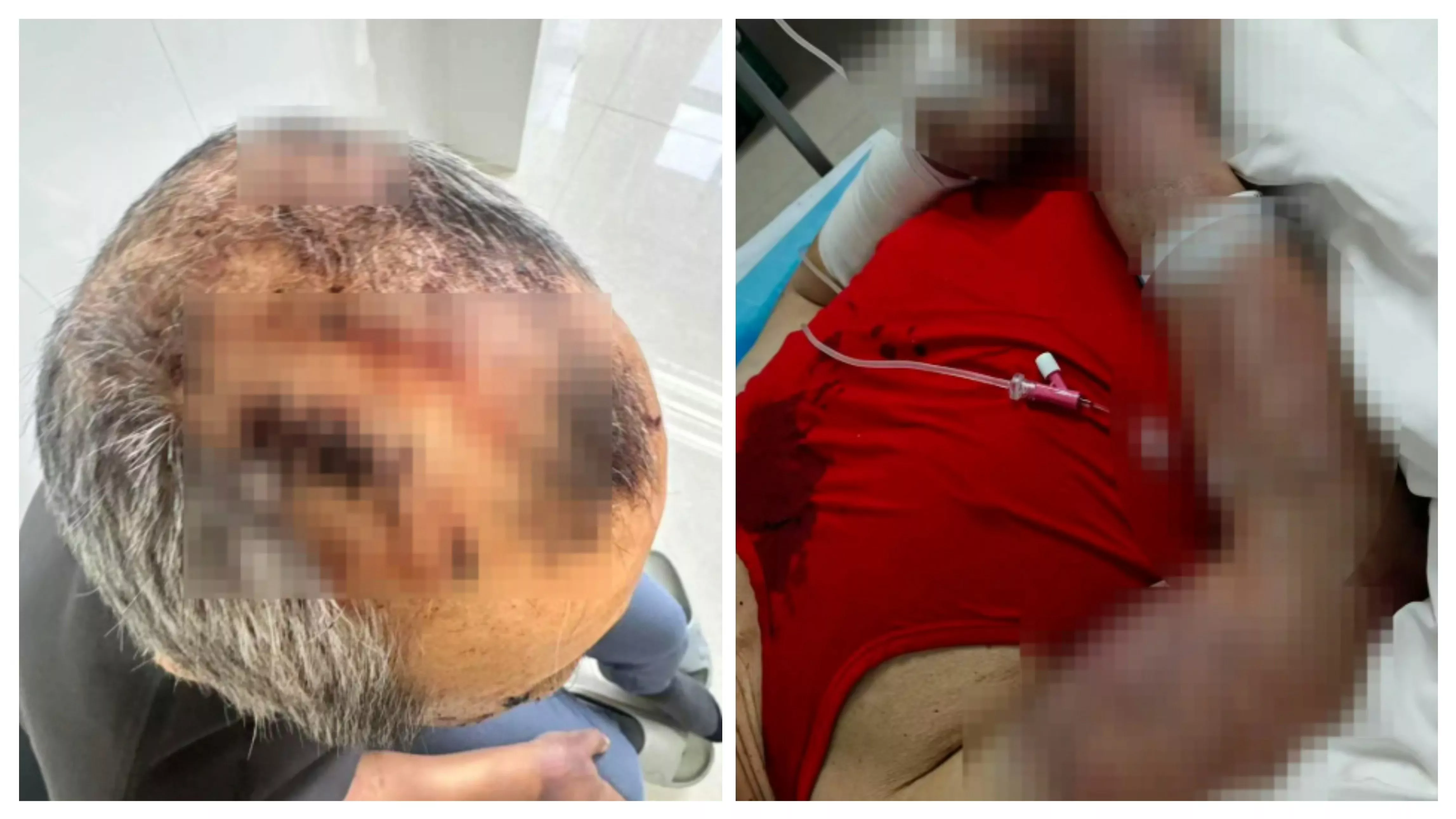 内蒙养老院7旬翁遭8旬同房虐打到失禁 木棍打断换铁拐杖