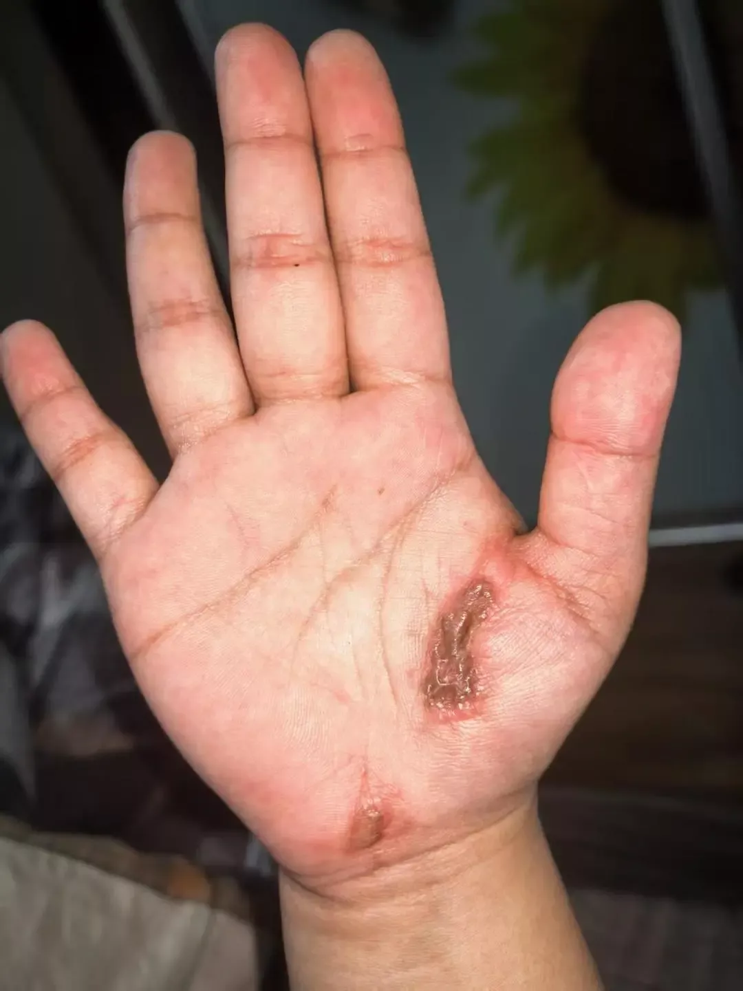 女子称边充电边玩手机遭电击，电流瞬间击穿全身