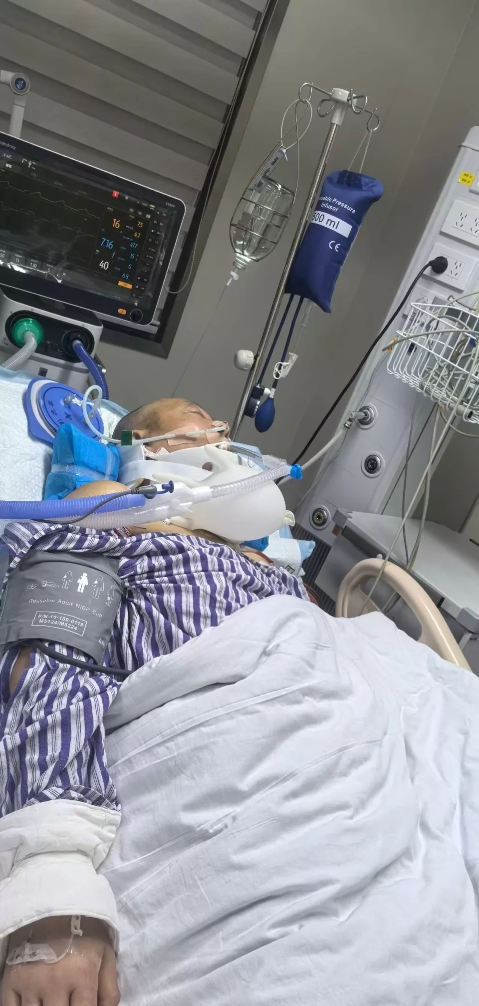 他健身时锁扣断裂被弹飞致下肢瘫痪，健身房称监控损坏